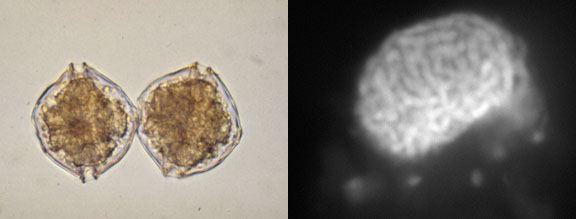 (A) Light microscopic image of Alexandrium tamarense. (B) DAPI-stained haploid cell of A. tamarense showing the numerous chromosomes.