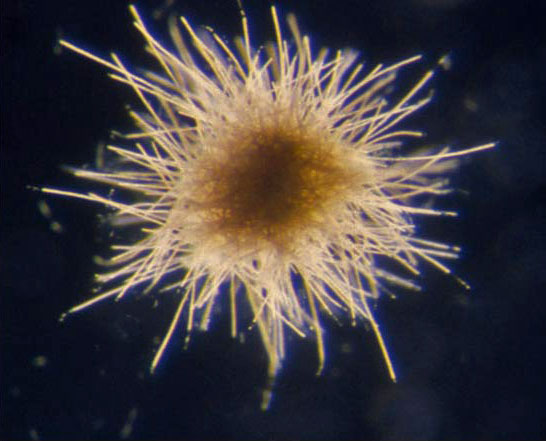 Ocean Microscope Reveals Surprising Abundance of Life
