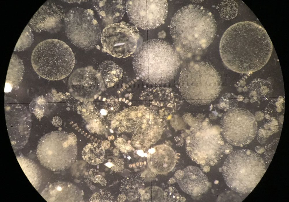 microbe