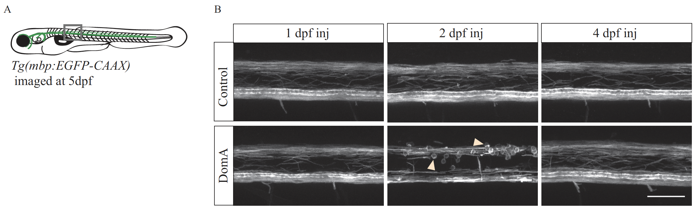 Figure 2.  Confocal imaging of myelin sheath structures of zebrafish exposed to domoic acid (DA) at different developmental days (A) Tg(mbp:EGFPCAAX) fish were used to visualize labeled myelin sheaths. (B) Representative images of fish exposed to DA (0.13–0.14 ng) during discrete periods in early development [1–4 days post-fertilization (dpf)], then imaged at 5 dpf using confocal microscopy. Arrows indicate the unusual circular membrane profiles. For details, see [1].