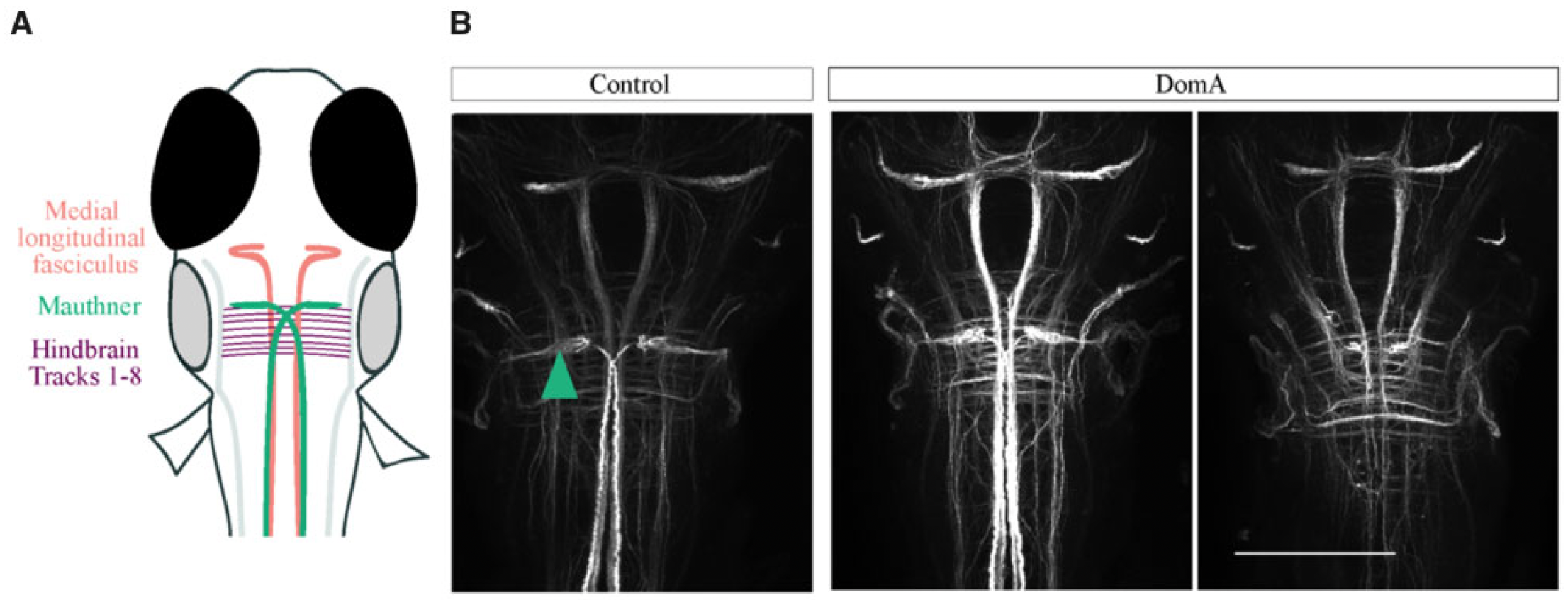 Figure 3.  The majority of DA-exposed larvae do not have Mauthner cells but have other hindbrain and midbrain structures. A, Schematic of brains stained with antibody 3A10, which labels Mauthner cells, medial longitudinal fasciculus, and hindbrain axonal tracts. B, Representative images of brains from control and DA-exposed larvae (5 dpf) stained with anti-3A10. Teal arrow points to Mauthner cell. Scale bar = 100 µm. For details, see [2].