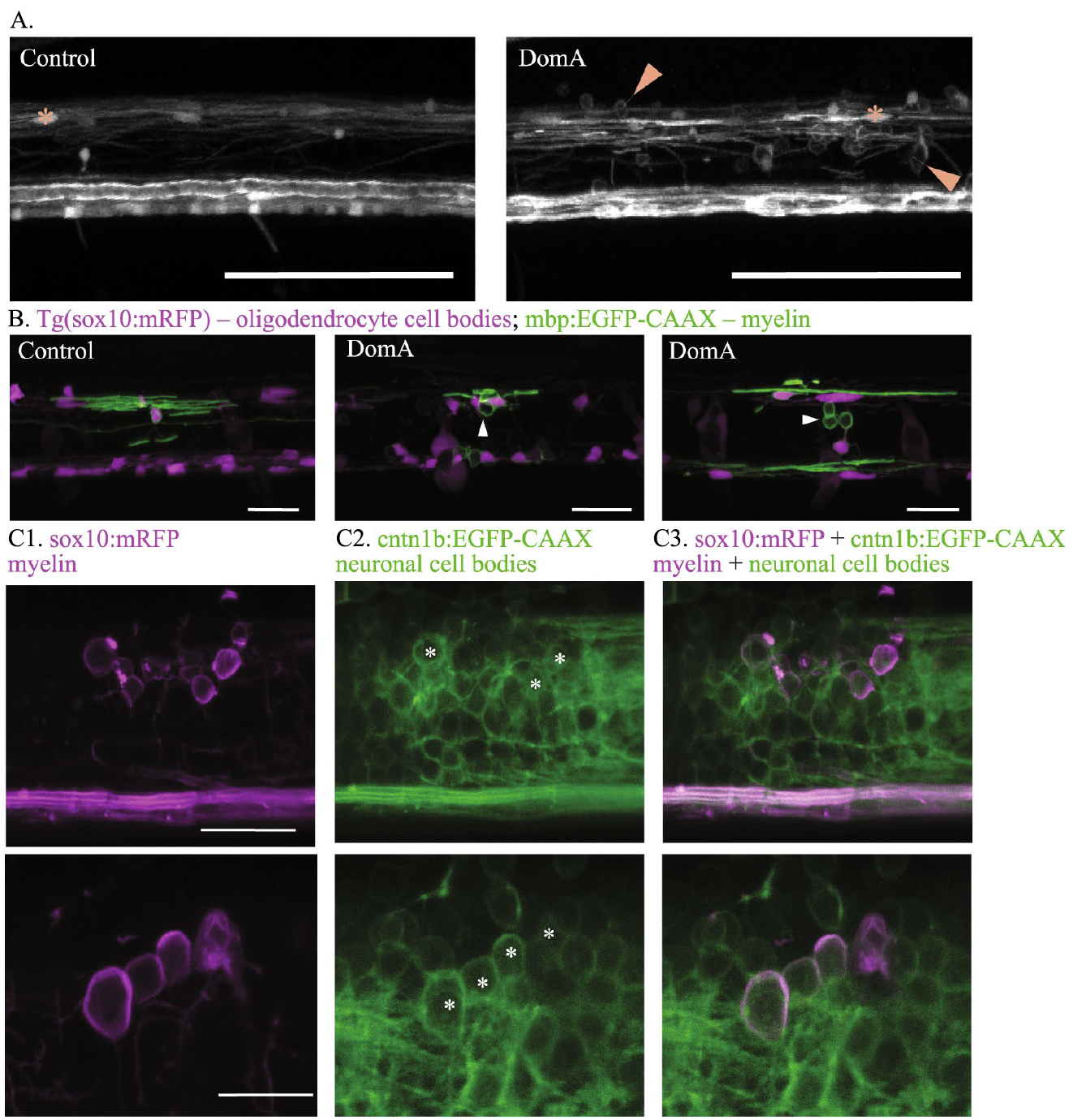 Panlilio JM, Hammar KM, Aluru N, Hahn ME (2023) Developmental exposure to domoic acid targets reticulospinal neurons and leads to aberrant myelination in the spinal cord. Scientific reports. 13(1):2587. https://doi.org/10.1038/s41598-023-28166-2